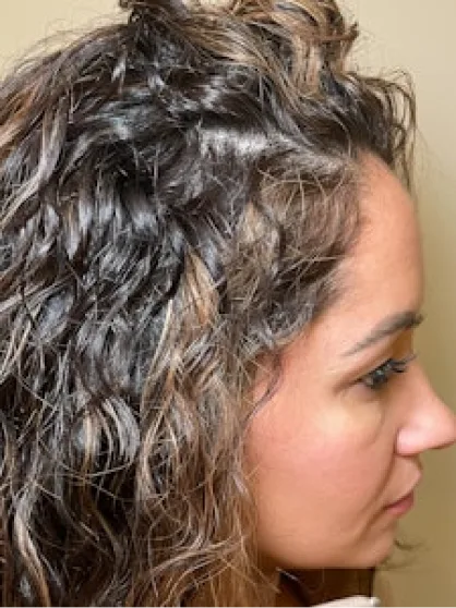 After treatment result