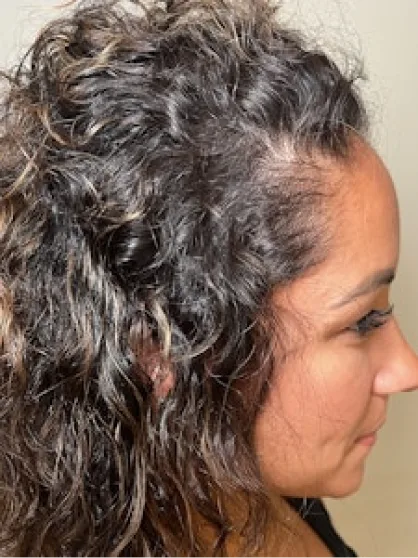 Before treatment result