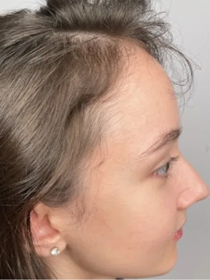 After treatment result