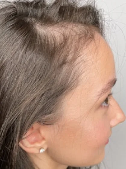 Before treatment result